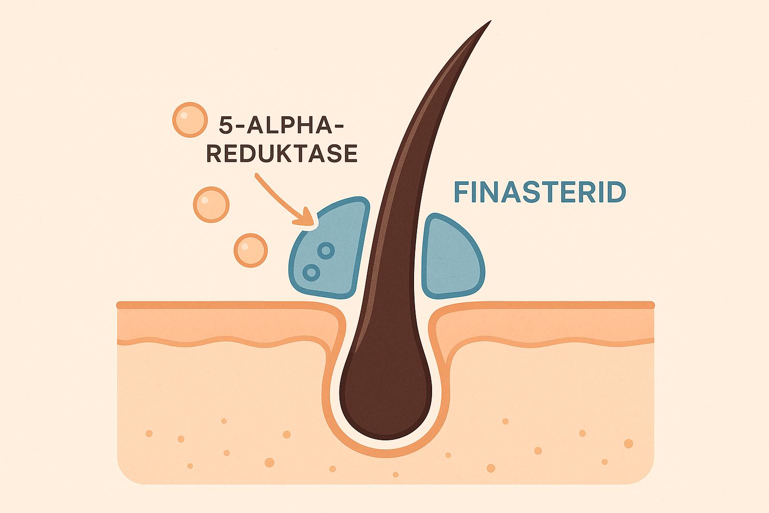 Wie wirkt Finasterid genau? (Und was bedeutet 5-Alpha-Reduktase?)