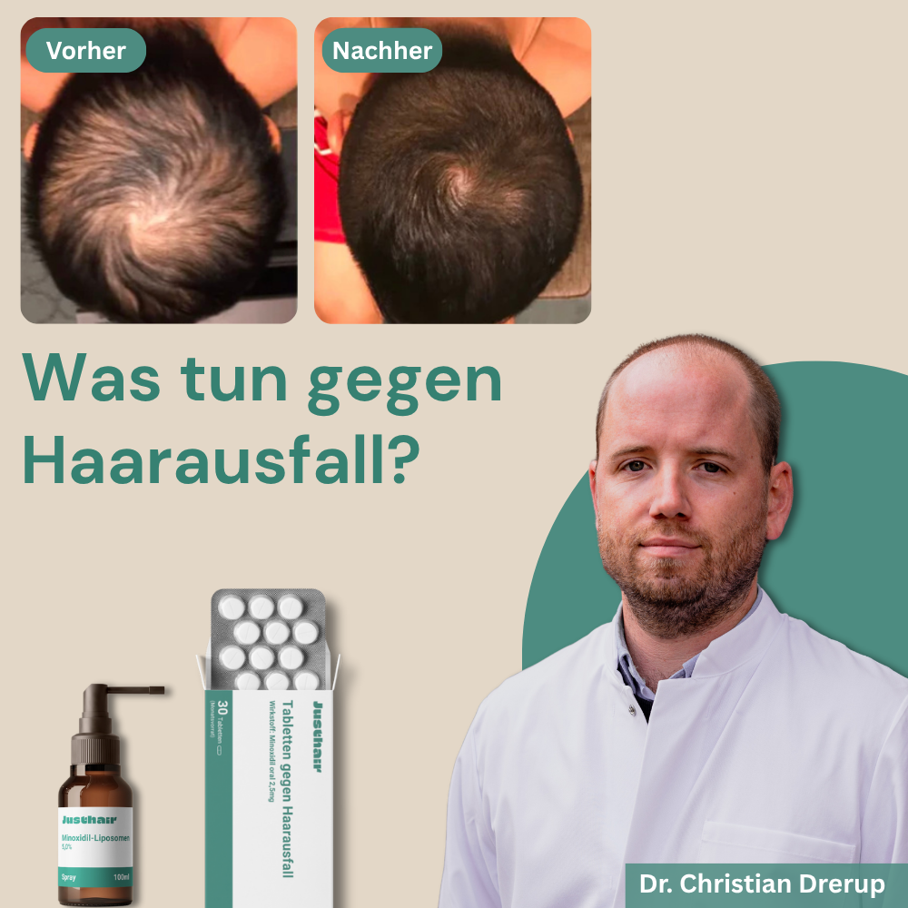 Top-Therapien für frühe Haarausfall-Behandlung