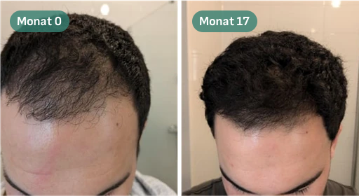 Vorher-Nachher-Bild der Haare